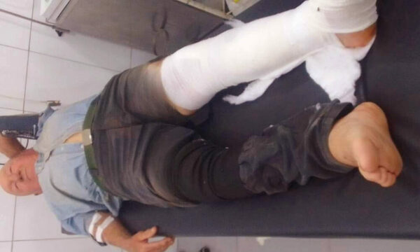 Conocido payaso de Curuguaty fue atropellado por un auto en la ruta