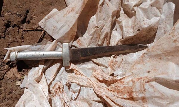 Intento de feminicidio: Mujer sufre corte en el cuello y su pareja se fuga – Prensa 5