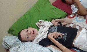 Organizan pollada para joven con discapacidad en Coronel Oviedo – Prensa 5