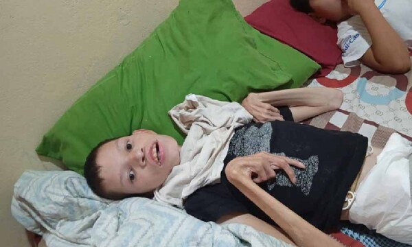 Organizan pollada para joven con discapacidad en Coronel Oviedo – Prensa 5