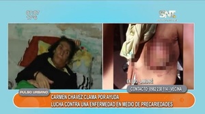 Carmen Chávez pide mucha ayuda - SNT