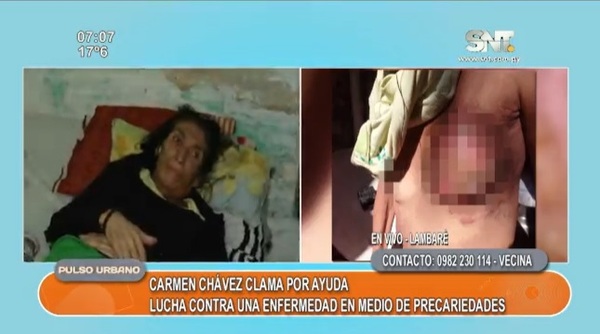 Carmen Chávez pide mucha ayuda - SNT