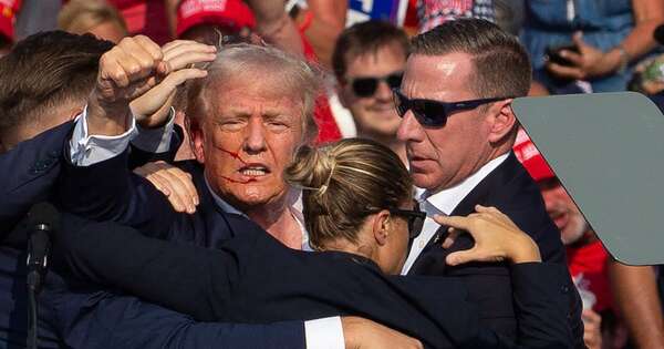 La Nación / Bala disparada a Trump estuvo a medio centímetro de perforar su cráneo, afirma médico