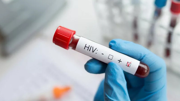 Por VIH en América Latina se registra más infecciones, pero menos muertes en 2023 respecto a 2010 - OviedoPress