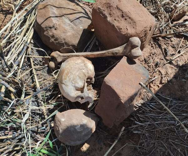 Hallan cráneo humano y restos óseos en propiedad rural de Amambay - Policiales - ABC Color
