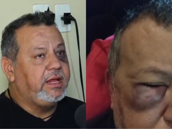 (VIDEO). Un hombre sufrió una brutal golpiza y podría perder un ojo