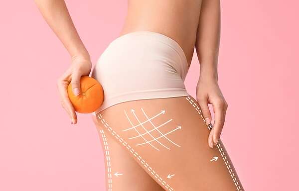Cómo reducir la celulitis de forma natural - Estilo de vida - ABC Color