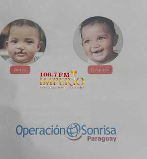 Exitosa cirugía a niño indígena con labio leporino