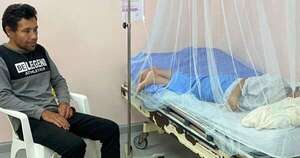 Diario HOY | Derramaron aguarrás y le quemaron la cara a un niño de 8 años en CDE