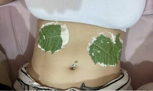 ¿Qué modelo usa este tratamiento para el famoso py’a ruru?