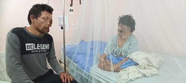 Niño sufre graves quemaduras en el rostro, le derramaron aguarrás y le prendieron fuego - La Clave