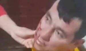 Policía causa disturbios en hospital y se resiste a sus camaradas – Prensa 5