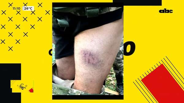 Otra agresión a cadetes: “no vamos a tolerar” dice ministro de Defensa - ABC Noticias - ABC Color