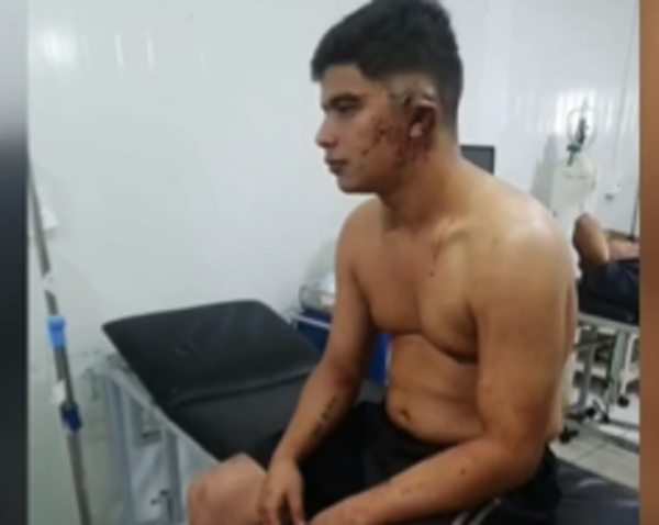 (VIDEO)Adictos iniciaron pelea y uno casi perdió la oreja