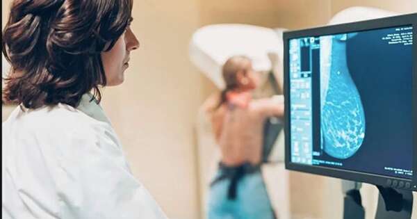 La Nación / Avances esperanzadores en la lucha contra el cáncer de mama