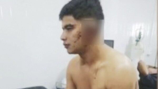Cortó la oreja al ami
