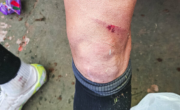 Versus / El reclamo de Olimpia por la criminal patada que sacó del partido a Derlis González