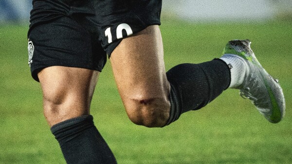 Fuerte reacción en Olimpia: Así quedó la rodilla de Derlis González