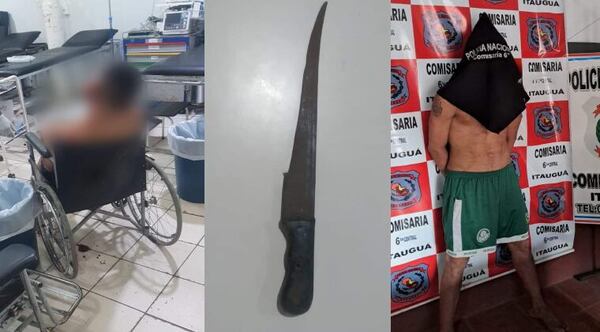 Discutió con su “amigo” y le cortó la oreja con un machetillo - Noticiero Paraguay
