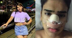 Diario HOY | La Sabri se sinceró sobre su rinoplastia “fallida”