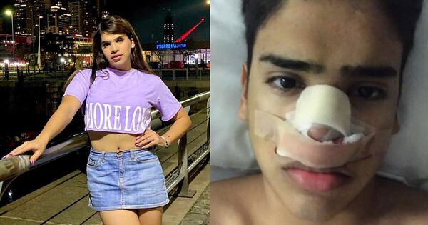 Diario HOY | La Sabri se sinceró sobre su rinoplastia “fallida”