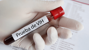 Alto porcentaje de diagnósticos de VIH en Paraguay se detecta en estado avanzado