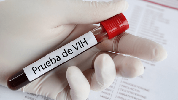 Alto porcentaje de diagnósticos de VIH en Paraguay se detecta en estado avanzado