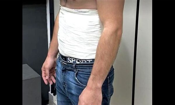 En Brasil detienen a paraguayo con 2 kilos de cocaína adheridos al cuerpo – Diario TNPRESS
