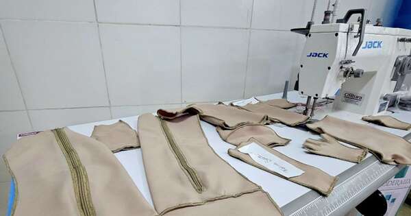 Diario HOY | Confeccionan ropa compresiva para adultos con cicatrices de quemaduras