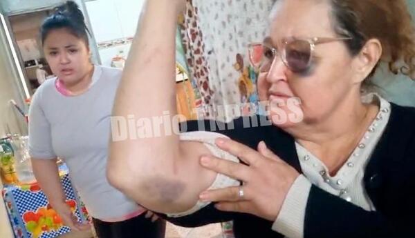 Gresca entre miembros de una familia movilizó a vecinos y a uniformados policiales en Minga Guazú – Diario TNPRESS
