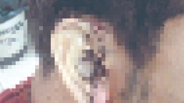 Dos exnovios de una chica se encontraron y se pelearon remal