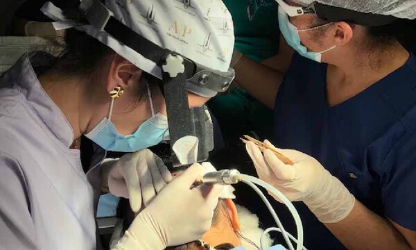 Realizan trasplante capilar a niña que sufrió quemaduras en el cuero cabelludo – Prensa 5