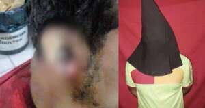 Diario HOY | Discutió con el novio de su expareja y le propinó un machetazo en la oreja
