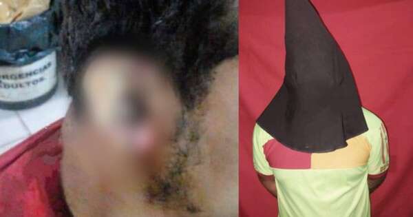 Diario HOY | Discutió con el novio de su expareja y le propinó un machetazo en la oreja