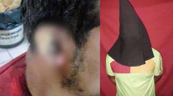 Discutió con el novio de su expareja y le propinó un machetazo en la oreja en Itá - Noticiero Paraguay