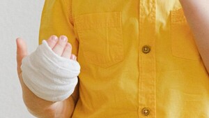 Quemaduras en niños: Los casos más comunes y cómo reaccionar ante un accidente