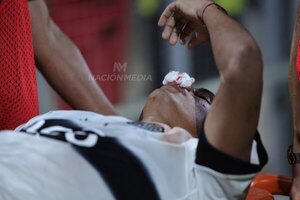 Versus / ¿Debió ser castigada? La acción que dejó con la nariz rota a Hugo Benítez