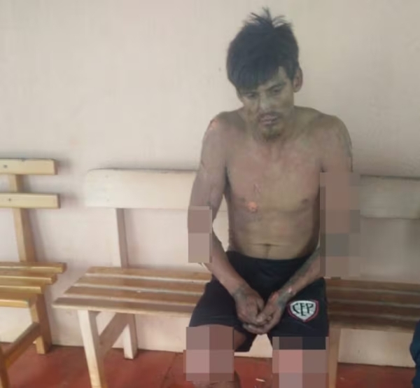 Joven se prende fuego y rechaza atención médica en Alto Paraná