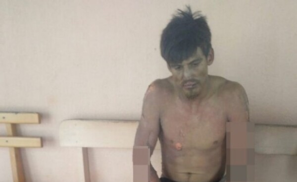 Joven se roció con combustible y luego se prendió fuego