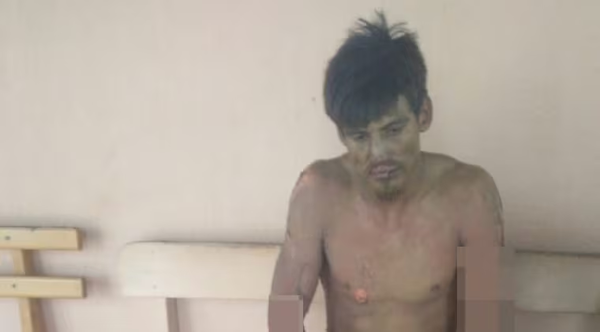 Adicto se derramó combustible por el cuerpo y se prendió fuego en Santa Rita - Noticiero Paraguay