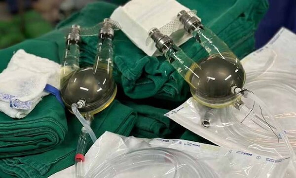 Conectan de urgencia corazón artificial a adolescente de 15 años – Prensa 5