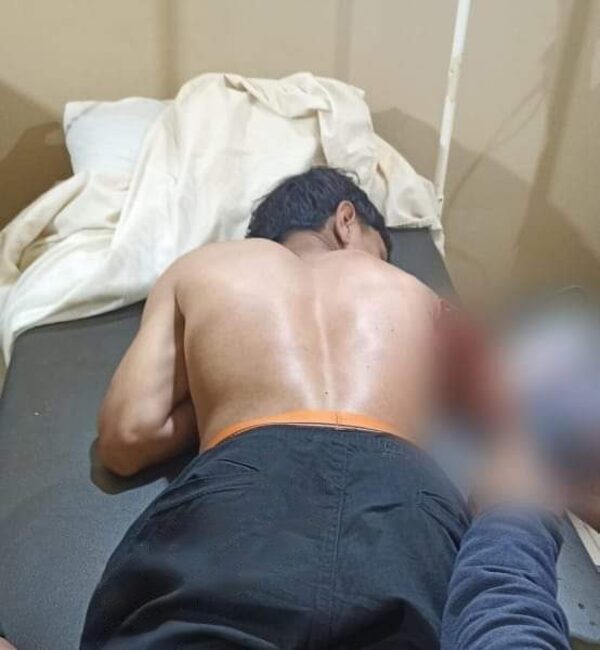 Guairá: fiesta patronal acabó con menor herido y mujer garroteada