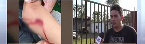 Denuncian inacción de fiscalía en el caso de una niña atacada por un perro - SNT