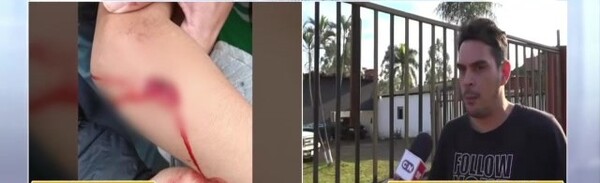 Denuncian inacción de fiscalía en el caso de una niña atacada por un perro - SNT