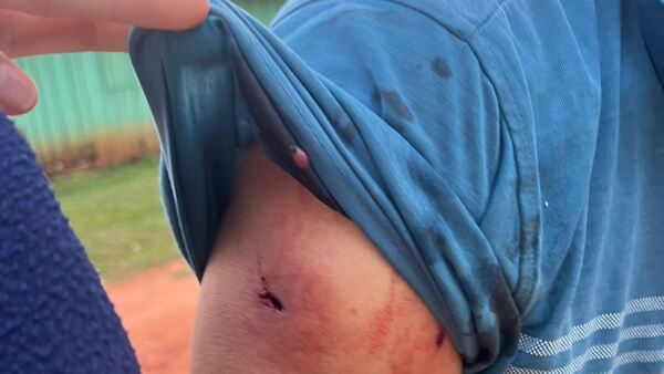 Denuncian invasión de propiedad con toma de rehenes y heridos en San Pedro