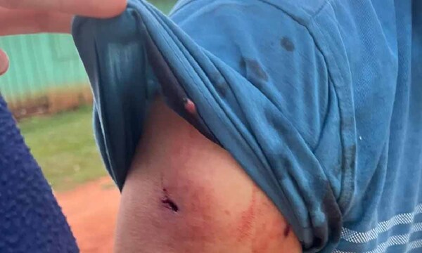 Denuncian invasión de propiedad con toma de rehén y heridos en San Pedro – Prensa 5