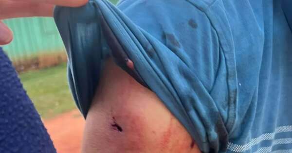 La Nación / Tras enfrentamiento, campesinos toman estancia en Capiibary