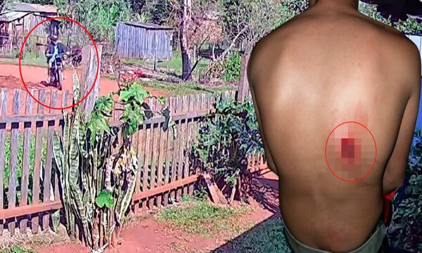 En Hernandarias, los insultos y choques se cobran a balazos que provocan heridos – Diario TNPRESS