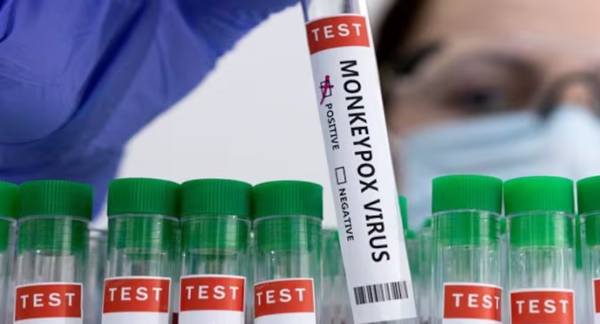 Europa registra el primer caso de viruela del mono en Suecia