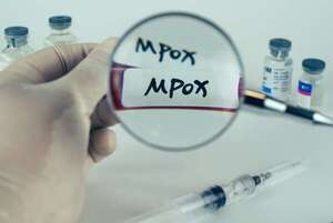 Perú emite una alerta epidemiológica sobre un nuevo linaje de Mpox - Mundo - ABC Color